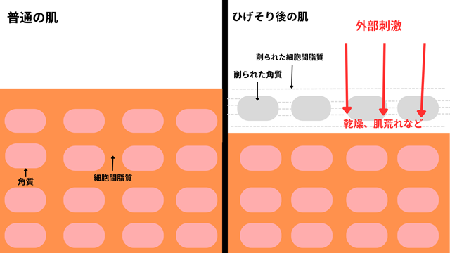 ひげそり後の肌
